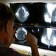 Illustration for article titled A Major Change to How Doctors Talk About Mammogram Results Is Coming Soon